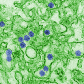 Digitally-colorized transmission electron micrograph (TEM) of Zika virus. From the CDC Public Health Image Library